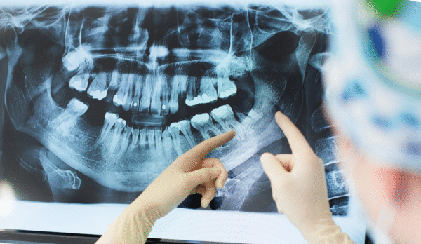 Digital Dental X-Ray Service in Jaipur | Swez Dental Clinic